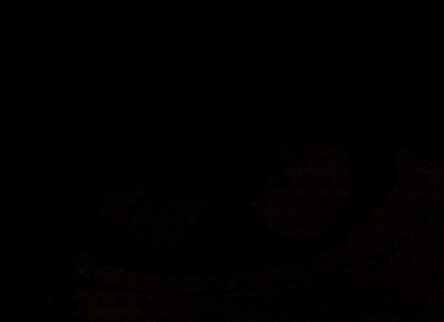 五斤肿瘤“霸占”腹腔，狭缝拆弹精准切除