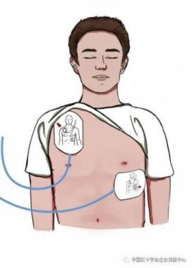 让“身边人”成为“生命守护人”