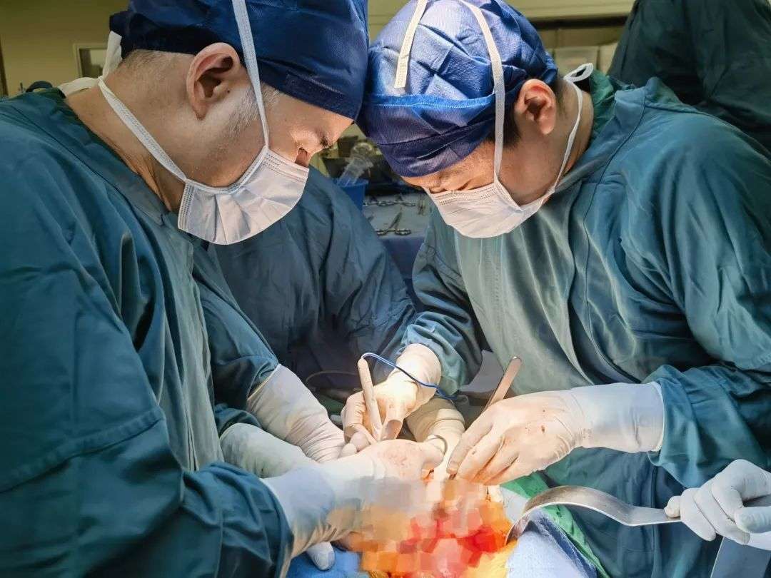 50cm长肿瘤从腹腔爬到心脏，多学科专家团队精准除瘤