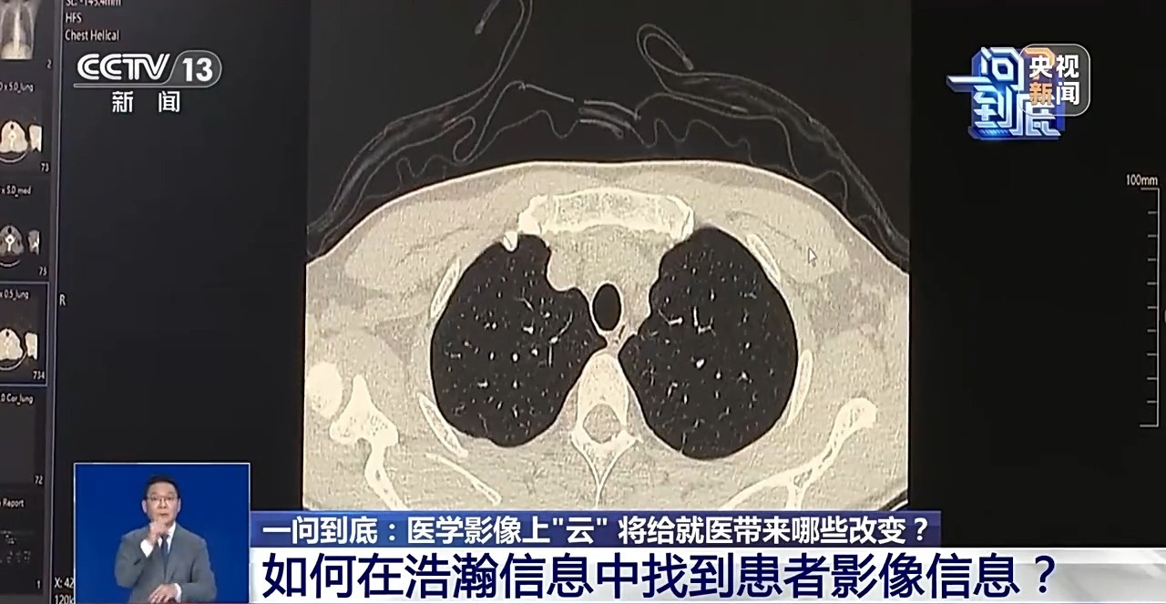 医学影像上“云”将给就医带来哪些改变?