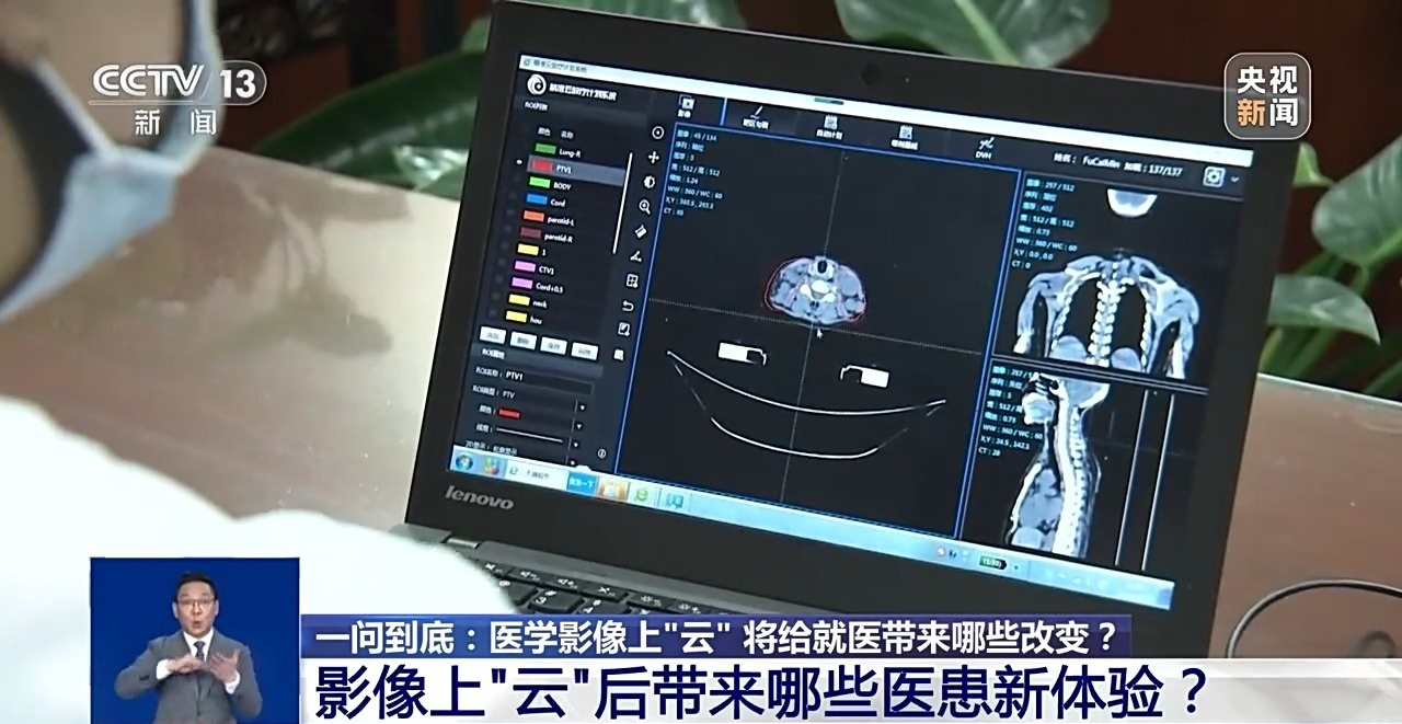 医学影像上“云”将给就医带来哪些改变?