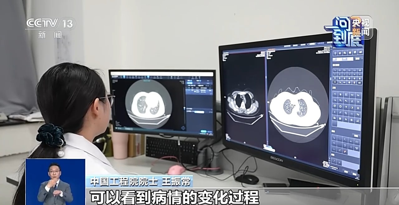 医学影像上“云”将给就医带来哪些改变?