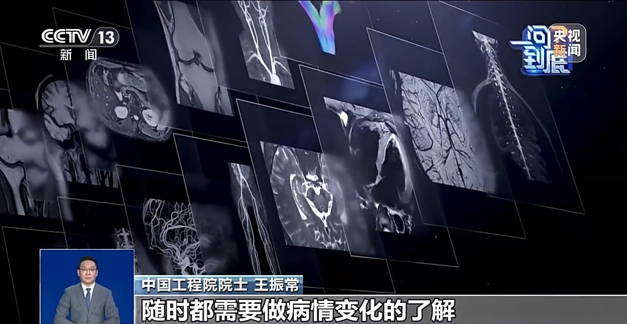 医学影像上“云”将给就医带来哪些改变?