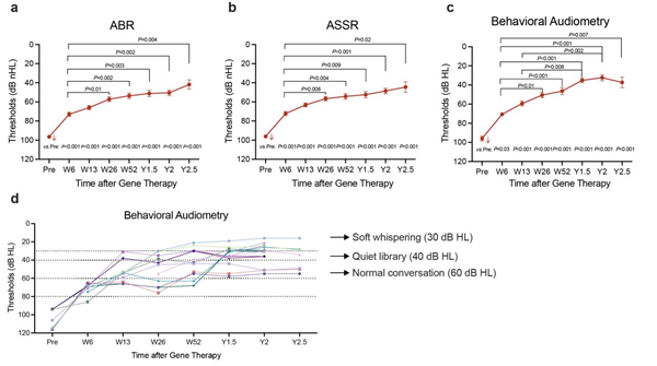 湘雅二医院汪芹教授团队合作在Nature发表先天性耳聋基因治疗多中心研究成果